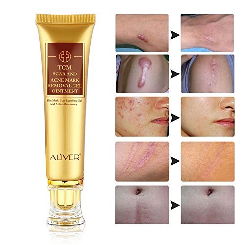 Scar Remover